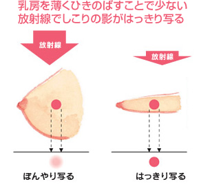 乳がん しこり 販売 枕に消ゴム